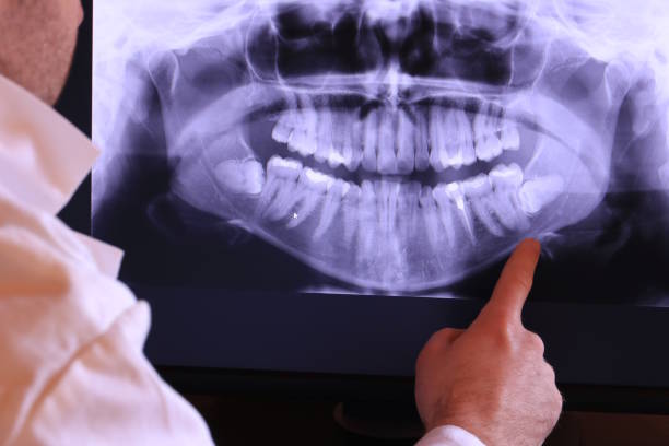 Best Emergency Treatment for Dental Infections or Abscesses in Odessa, MO